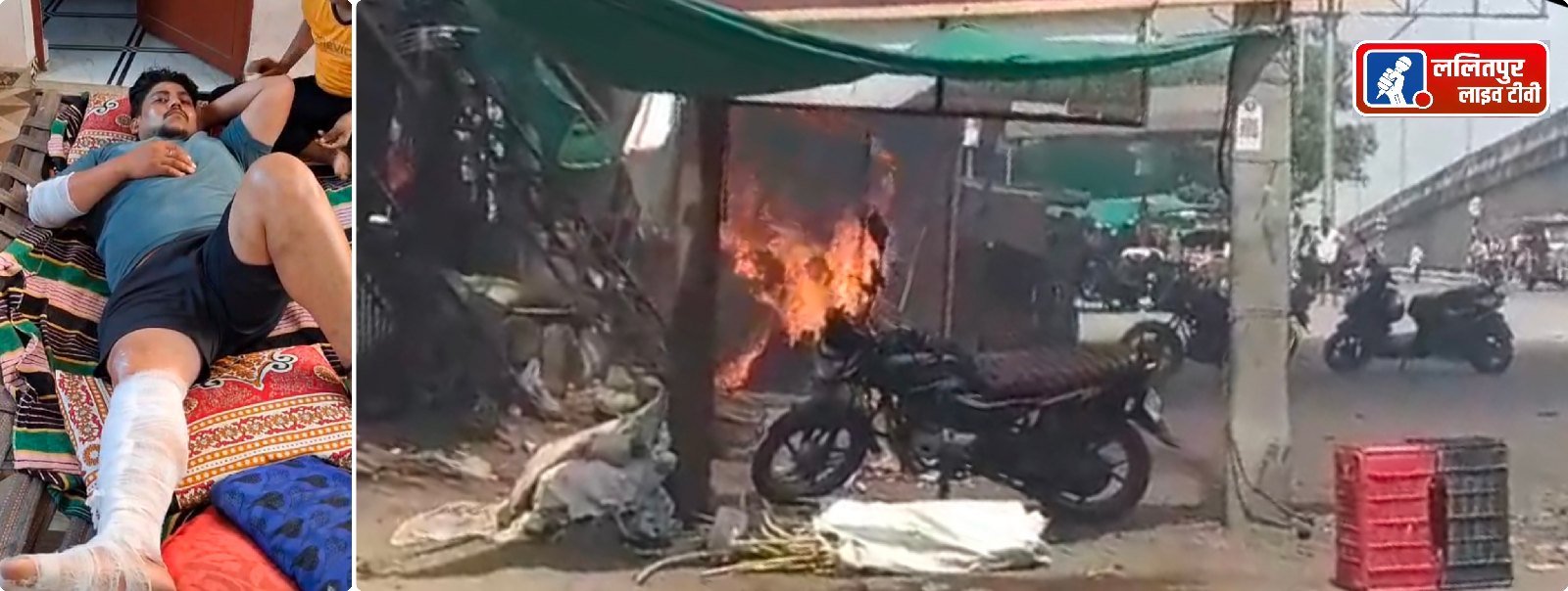 सिलिंडर लीक होने से तीन दुकानों में भीषण आग, समोसे बनाते समय हुआ हादसा; दुकानदार झुलसा, लाखों का नुकसान