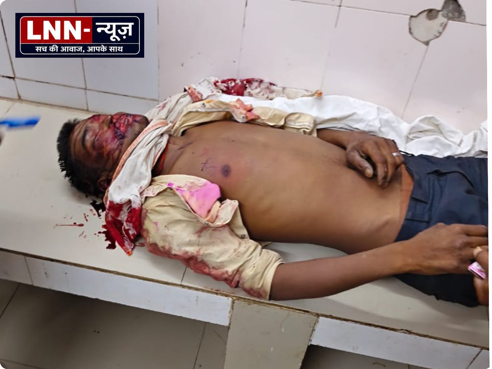 तेरंई फाटक क्षेत्र के हसारी गांव में अनियंत्रित होकर एक बाइक खंभे से टकराई बाइक सवार व्यक्ति हुआ गंभीर रूप से घायल जिसे डॉक्टरों ने किया मृत घोषित.