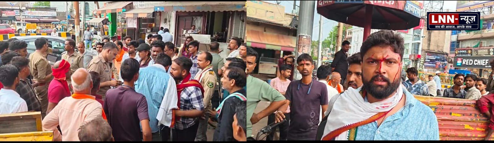 बैगन के भरता को लेकर हुई कहा सुनी में खाना खाने आए रिश्तेदार ग्राहक के साथ दुकानदार और उसके चेलों ने बुरी-बुरी गालियां दी फिर मार-मार कर उसका सिर फोड़ दिया.