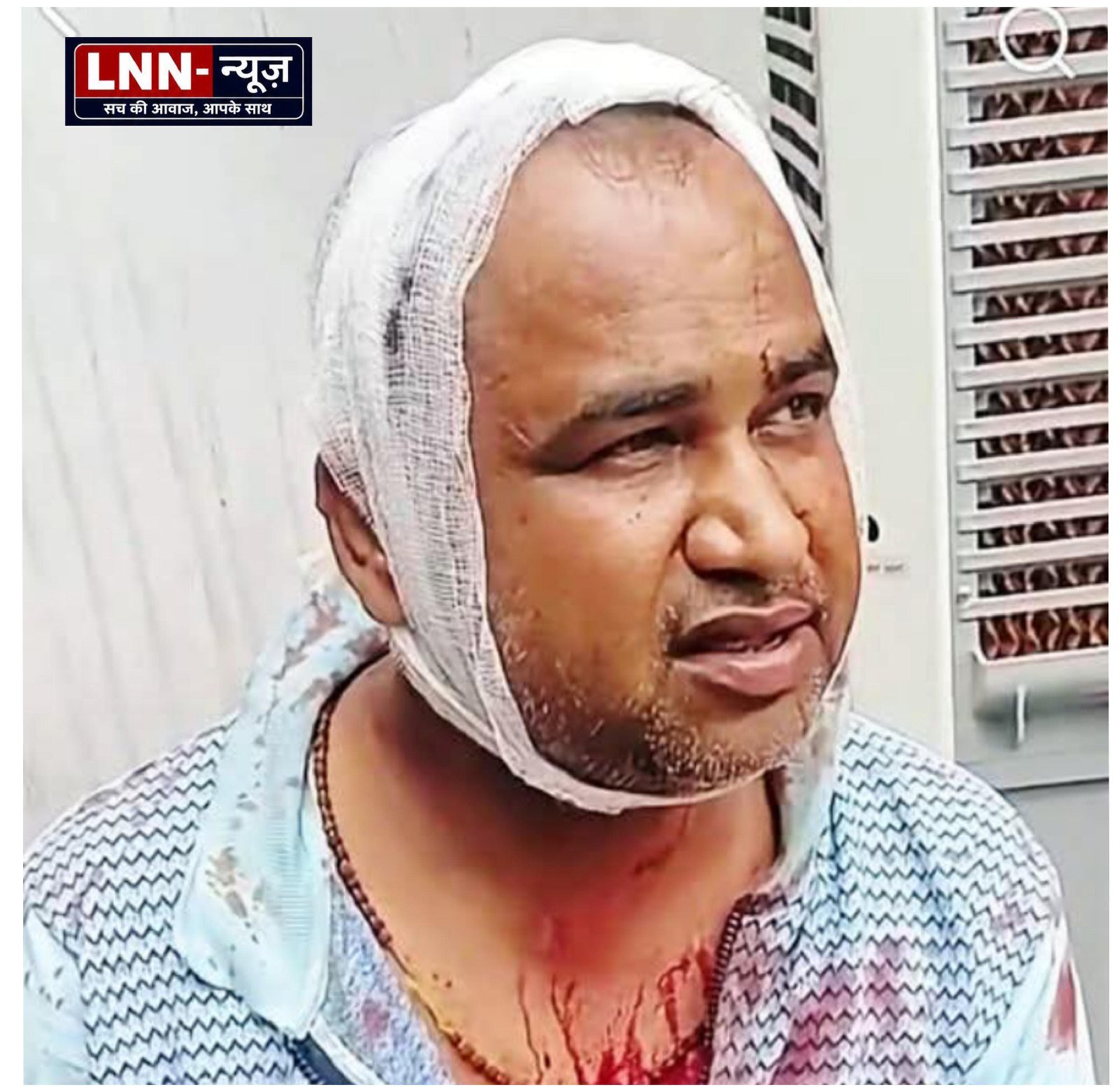 ललितपुर में भाजपा के दलित नेता पर लाठी-डंडों से हमला,हमलावर जान से मारने की धमकी देकर हुए फरार.
